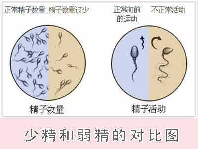 弱精子症的常见原因