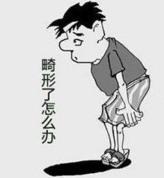 阴茎畸形常见的4大分类