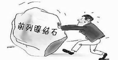 前列腺结石手术多少钱