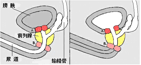 射精延迟影响大吗