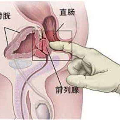 为什么会阴茎弯曲