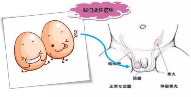 隐睾危害大吗